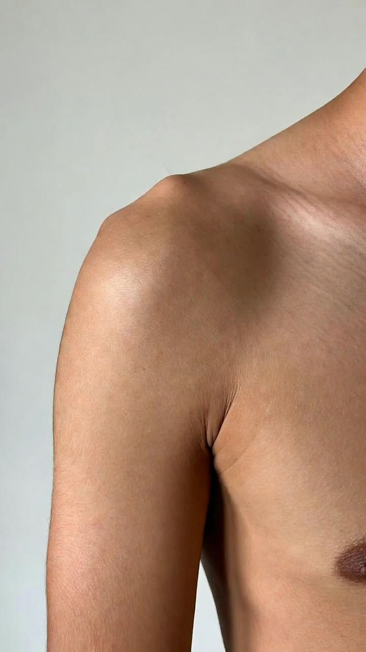 Acromion