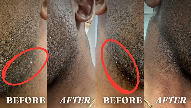 Randall Before and after | Natural Skincare for Sensitive Skin