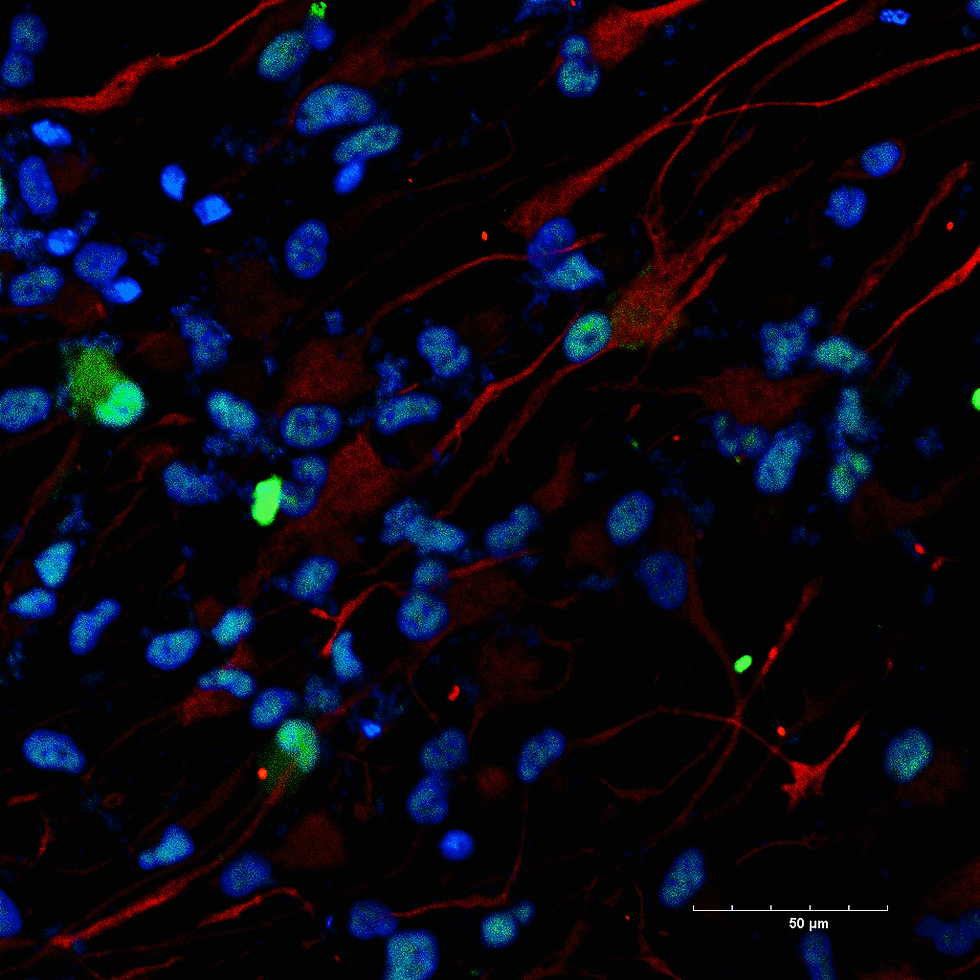 Tracing dreams by Qin Lin