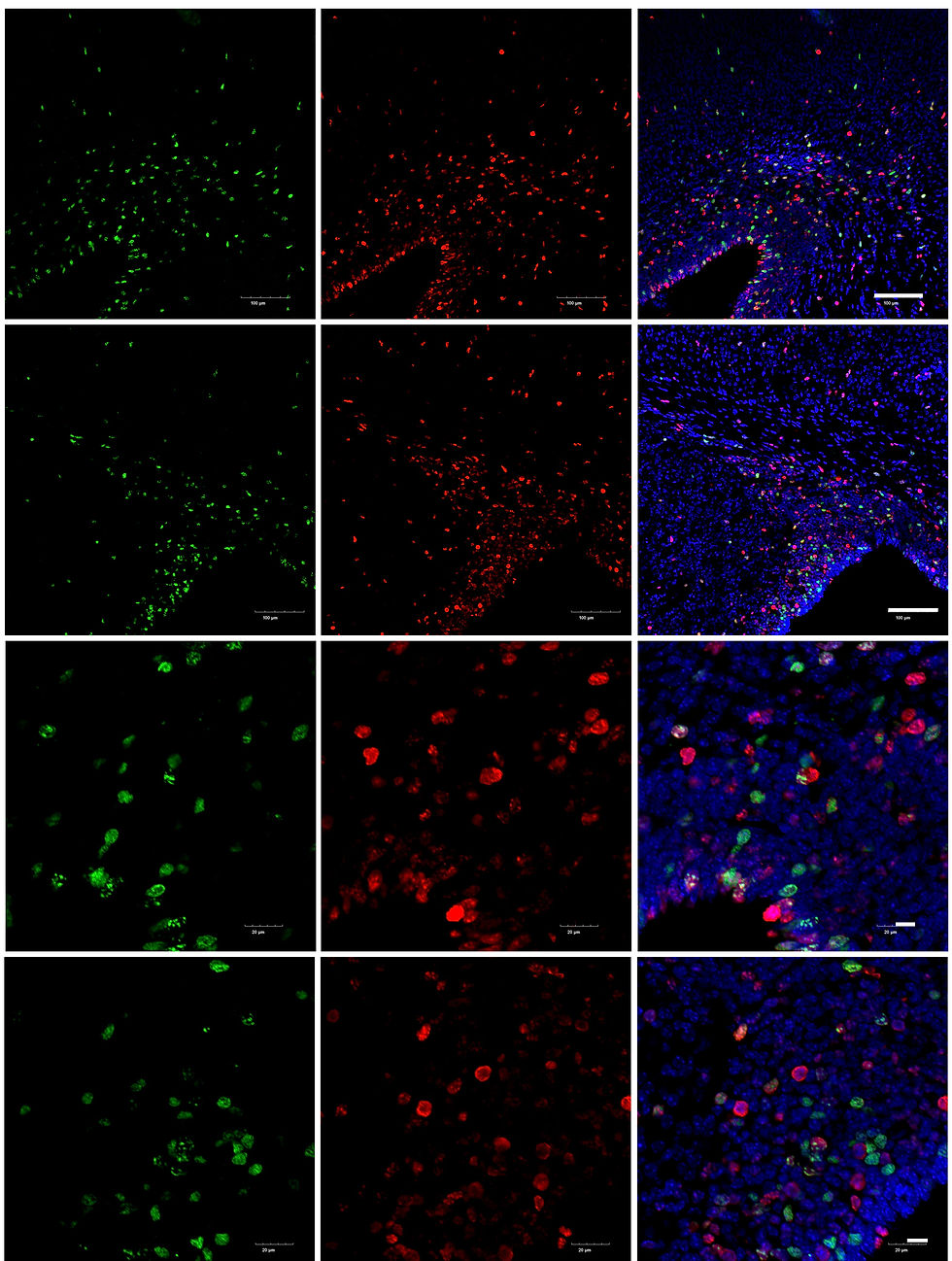 Playing with cell cycle by Qin Lin