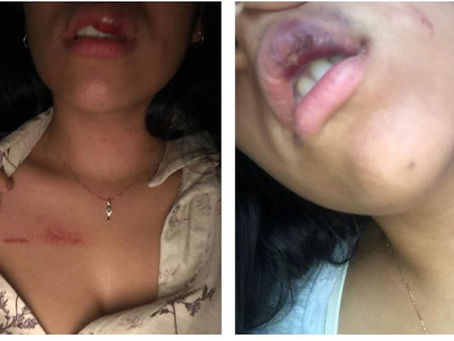 El nombrado rey vallenato José Ricardo Villafañe, será llevado a juicio por golpiza contra su novia