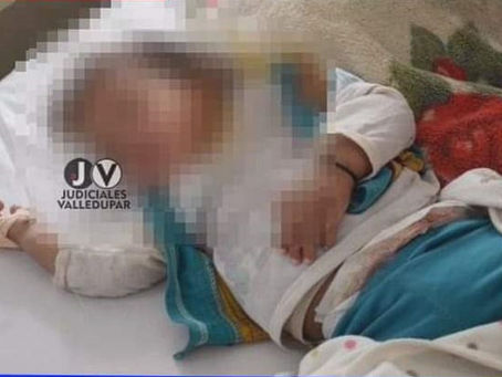 Padrastro mata a golpes a niña de 2 años en La Loma, Cesar
