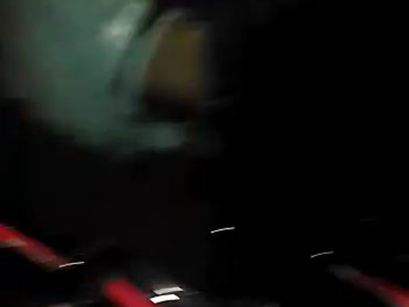 Motociclista pierde su pierna izquierda por andar haciendo Piques en la vía alterna de Sta Mta