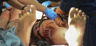 Stop the Bleed: 8 trampas para evitar en el control de la hemorragia