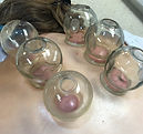 Traditional fire cupping for pain relief, detoxification, and deep muscle relaxation