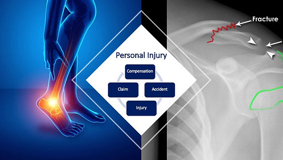 Personal Injury Accidents