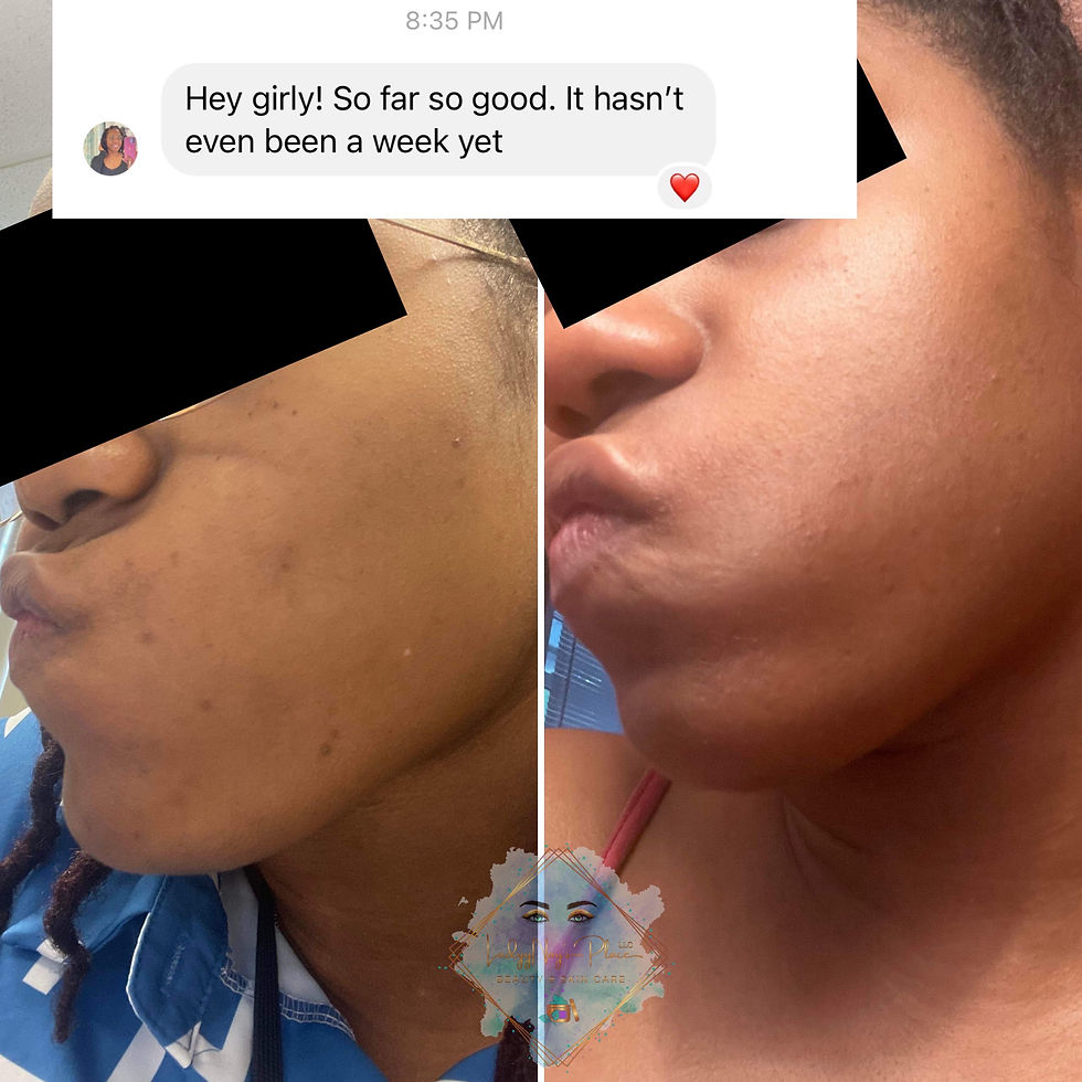 Thumbnail: Face & Body Scrub Mask