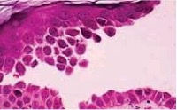 Light Microscopy (H&E)