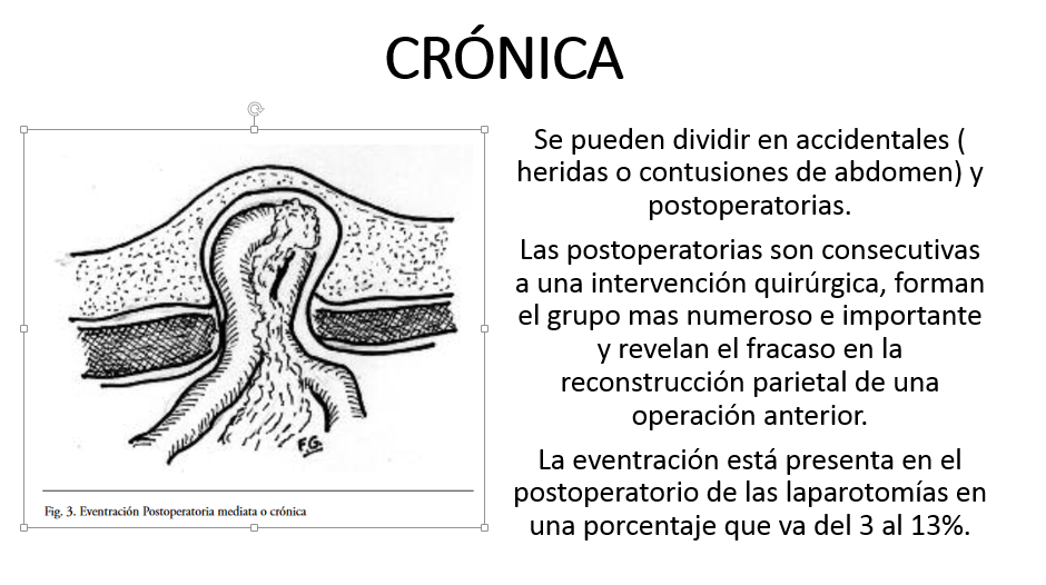 cronica
