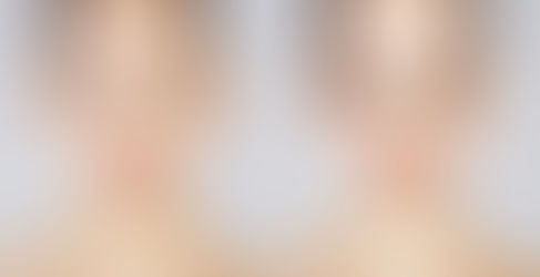 Selfies, réseaux sociaux et image de soi à l’adolescence : attention danger ?