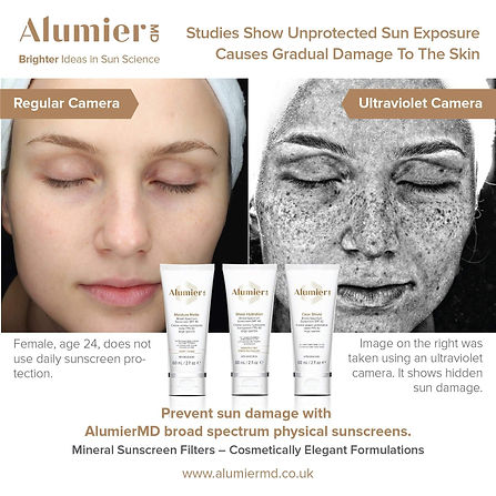 sun damage.jpeg