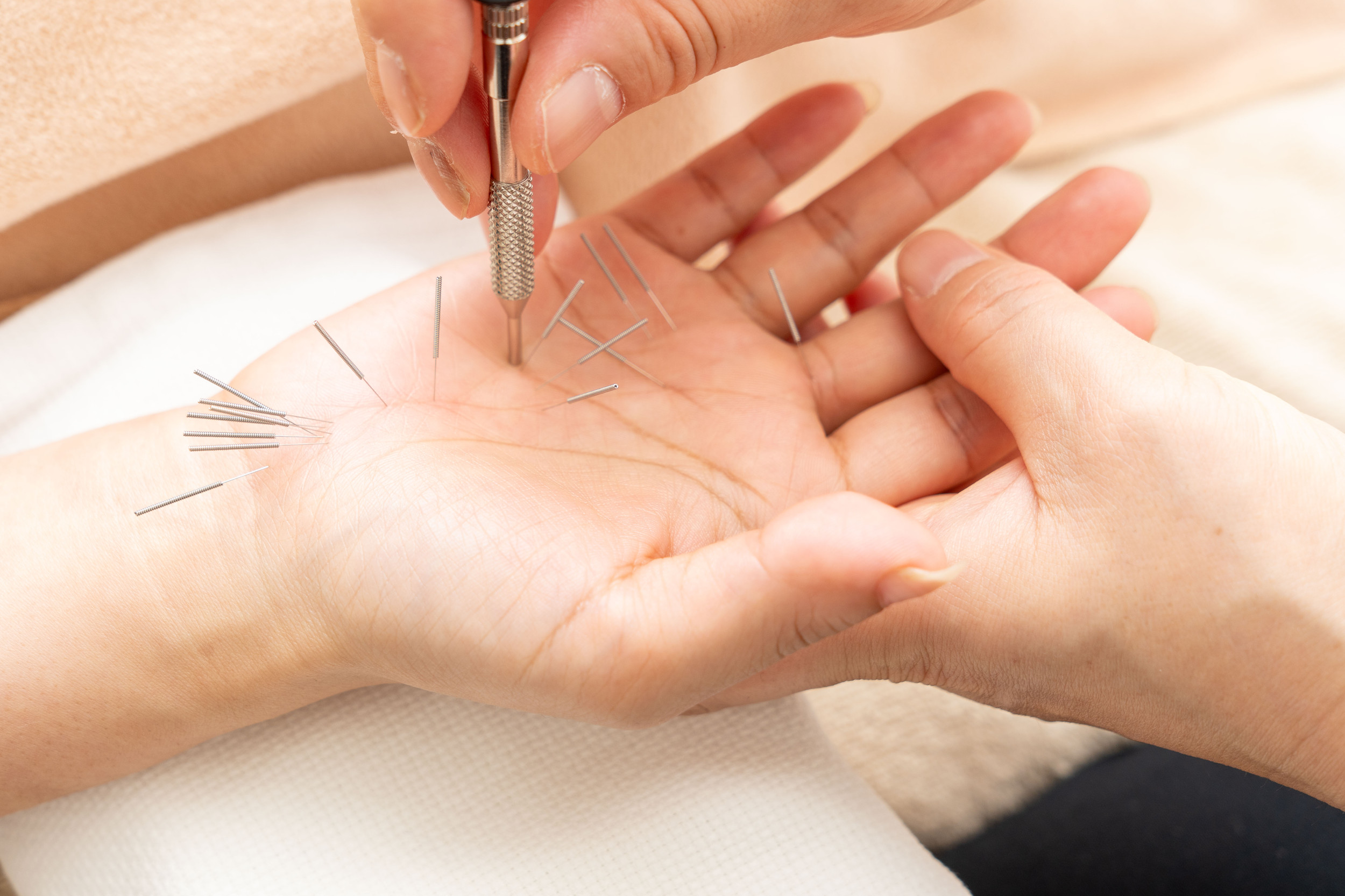 手指鍼コース | 高麗鍼灸院 〜 千駄ヶ谷駅から徒歩5分