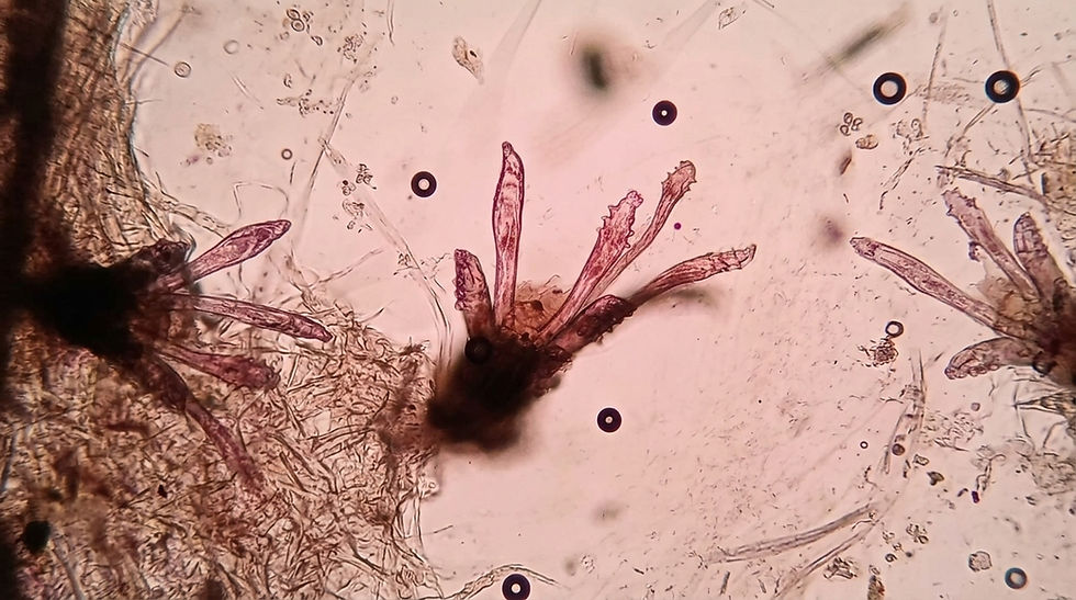 Ácaros Demodex observados al microscopio durante una prueba diagnóstica en UNIMEL.