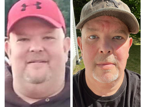 Showcase before & after results front and center 