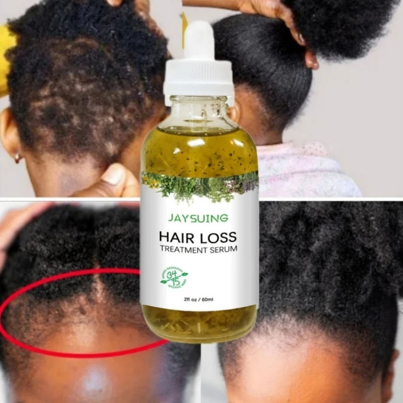 Afro Regrowth Herbal Hair Growth Treatment Oil