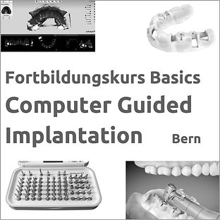 Basics-Kurs Computer Guided Implantation