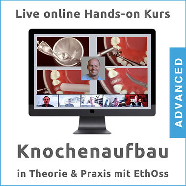 Knochenaufbau in Theorie und Praxis mit