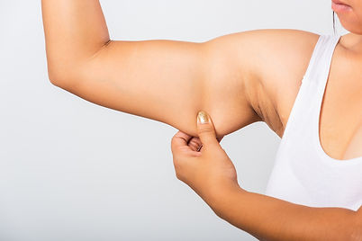 Underarm