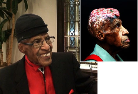 80 ANOS COM UM BURACO NA CABEÇA FEITO POR EXPERIÊNCIAS RACISTAS EM 1927