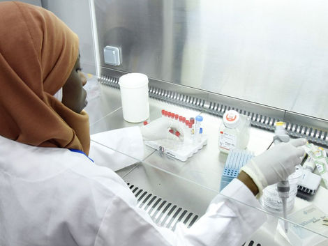 SENEGAL AVANÇA COM FABRICAÇÃO DE KITS DE TESTE PARA O CORONAVIRUS
