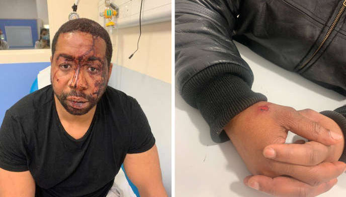 15 MINUTOS DE SOCOS E INSULTOS RACISTAS DE TRÊS POLICIAIS EM PARIS CONTRA UM PRODUTOR MUSICAL NEGRO