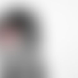 What to do when you are having a Migraine attack?