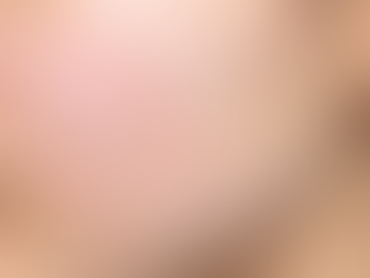 Pityriasis Alba skin condition - Apollo Homeopathy Clinic Brampton