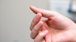 Trigger Finger - Apollo Homeopathy Clinic Brampton