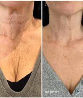 neckkk.jpeg