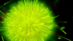 September 2023 Blue green algae (cyanobacteria) blooms in Lake Gervais