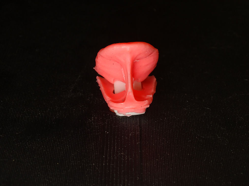 Thumbnail: Tongue for Frenectomy Model