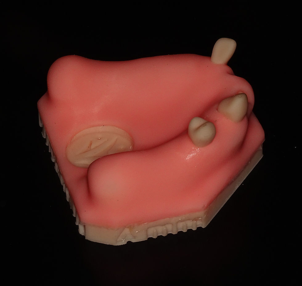 Thumbnail: Sinus Lift Model