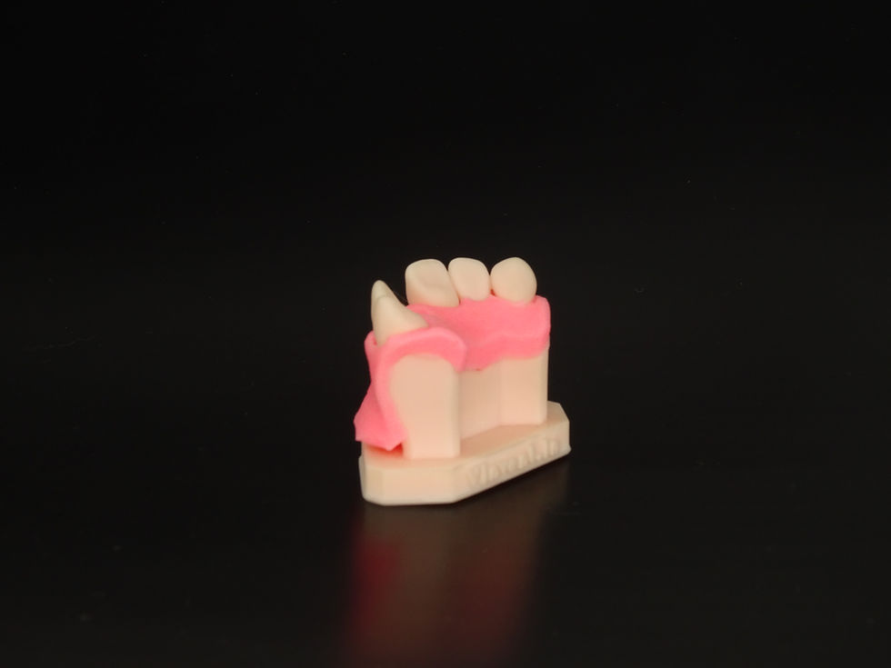 Thumbnail: PET: Partial Extraction Technique
