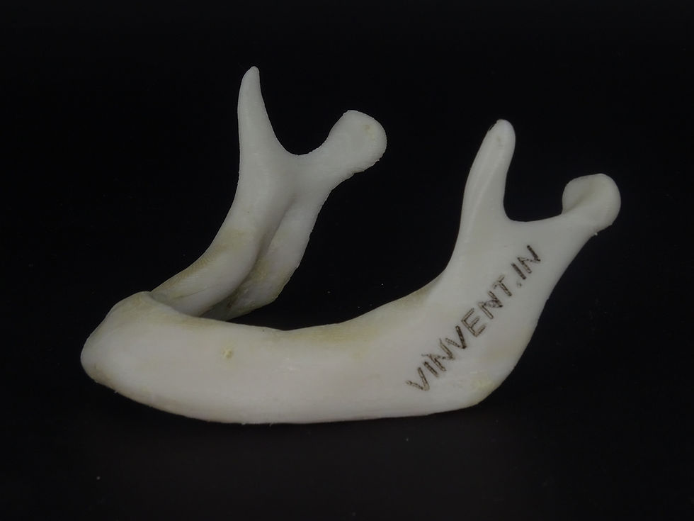 Thumbnail: Completely Edentulous Mandible