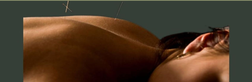 Akupunkturbehandlung auf dem Rücken – Nadelkunst für ganzheitliche Gesundheit, Balance und Entspannung in St. Gallen