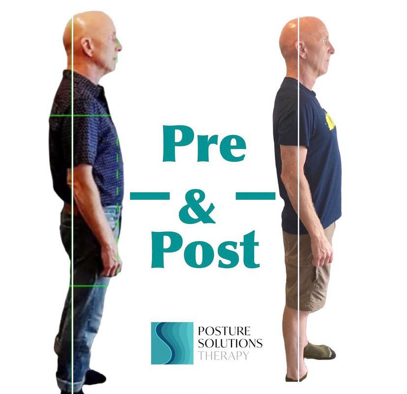 A before and after graphic of a Posture Therapy Client, showing the improvement of his posture.