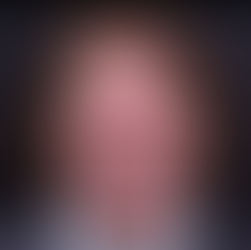 PARODONTITE AVANZATA: UNA SOLUZIONE DEFINITIVA CON GLI IMPIANTI A CARICO IMMEDIATO