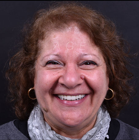 Donna sorridente con potesi fissa ai denti