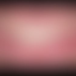 Paziente con dente fratturato prima e dopo l’inserimento di un impianto a carico immediato con corona provvisoria