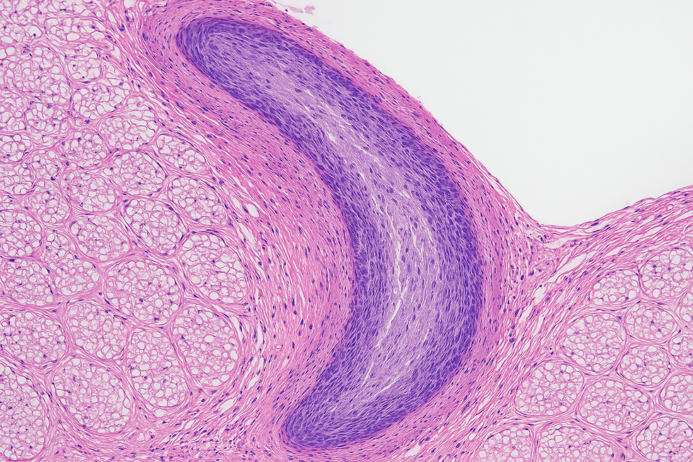 7 Alimentos que Mejoran tus Erecciones de Forma Natural (Sin Pastillas) en Men Solutions Madrid España