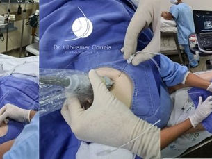 Medo de cirurgia e anestesia: os procedimentos evoluíram 100%