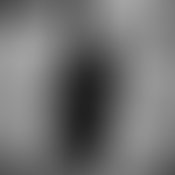 Ultrasound Meets Ham Radio