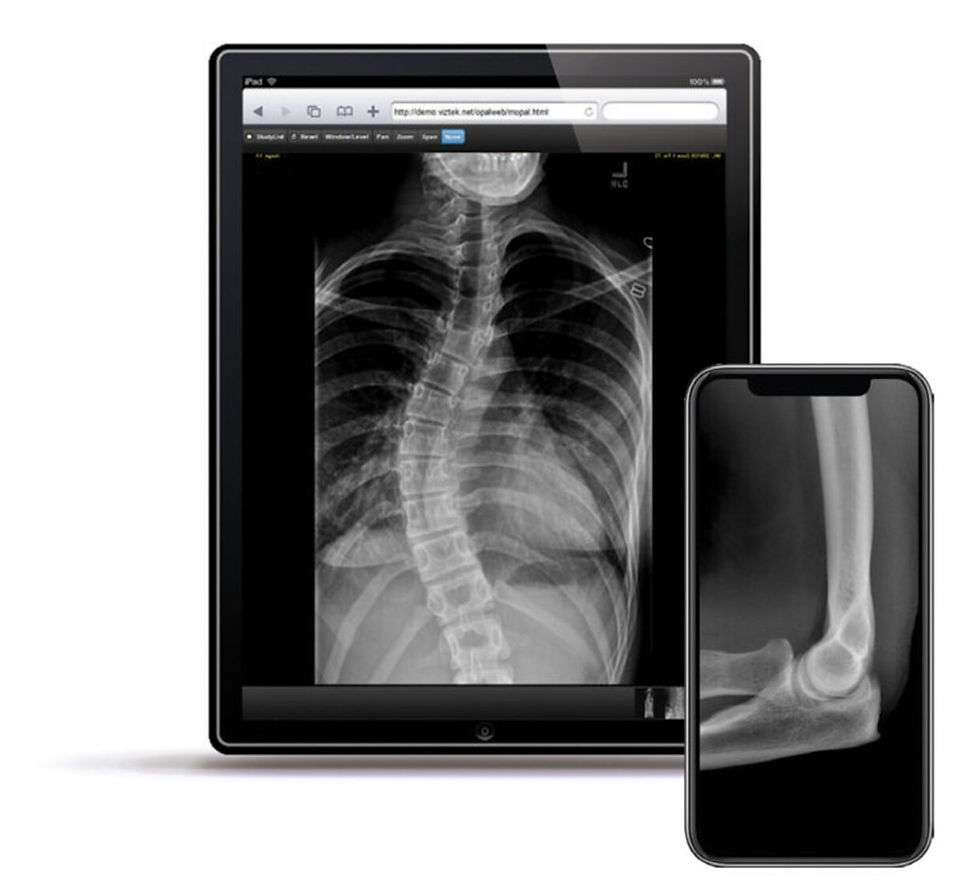 PACS y RIS, la columna vertebral invisible del diagnóstico moderno
