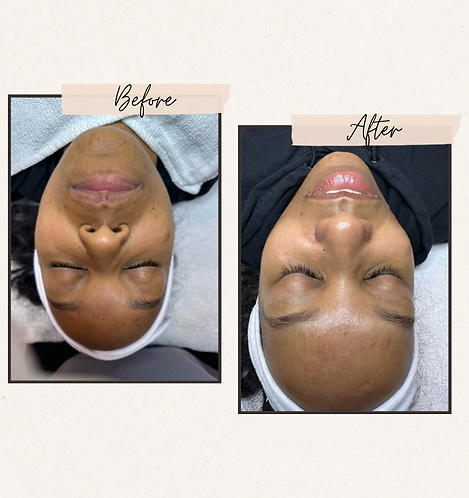 Neutral Rustic Before After Photos Instagram Post.png