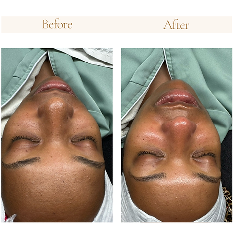 Neutral Before and After Instagram Post (Website).png