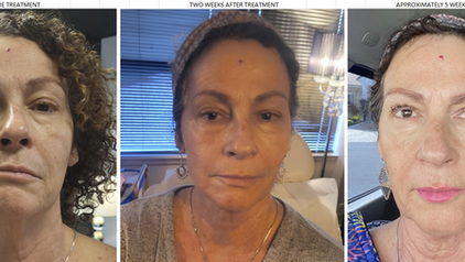 Beauty by Design: Where “Change of Body. Change of Mind.” Comes to Life in Temecula.