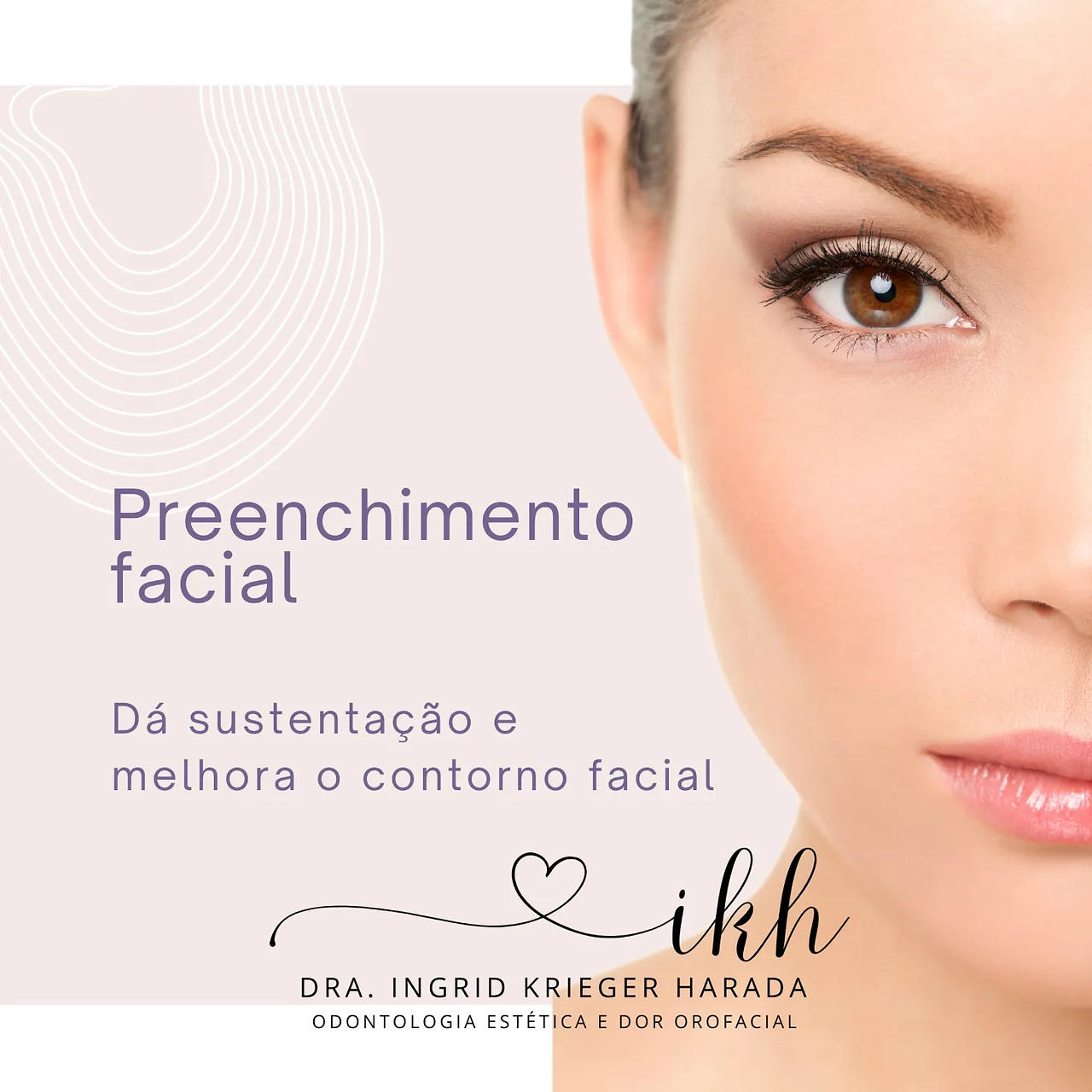 Preenchimento facial