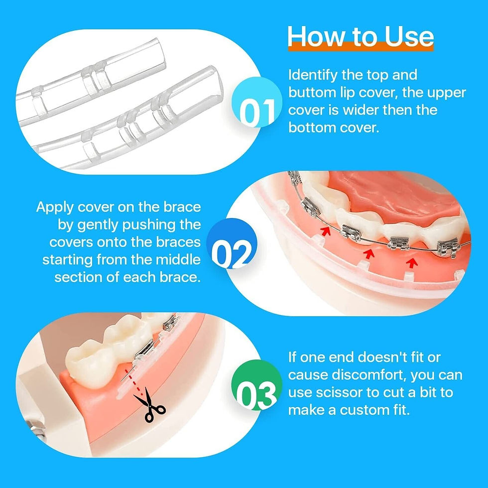 Braces Mouthguard Top And Bottom Discounted Online www.meesenburg.kz