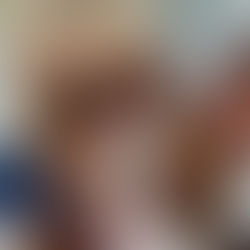 Dog With Critical Injury From An Electric Scooter Accident Surrendered to Old Dominion Humane Society And Quickly Adopted