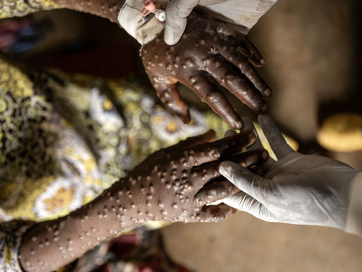 África registra quase 50 mil casos de Mpox confirmados